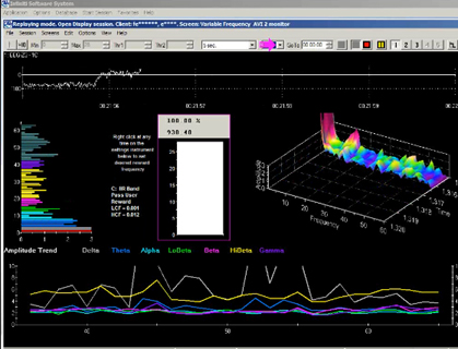 1I. LOW FREQUENCY NEUROFEEDBACK SUITE